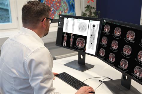 hermes medical solutions aktiebolag|hermes molecular imaging software.